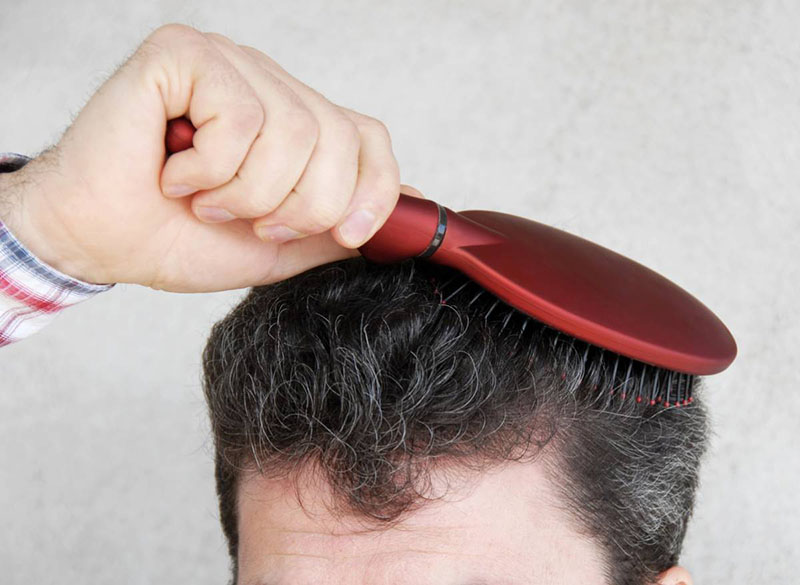 Lựa chọn lược chải đầu khắc phục rụng tóc ở nam giới